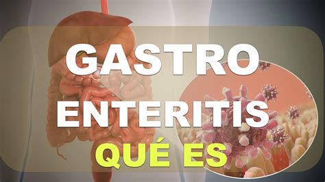 ¿qué Es La Gastroenteritis Explicación Youtube