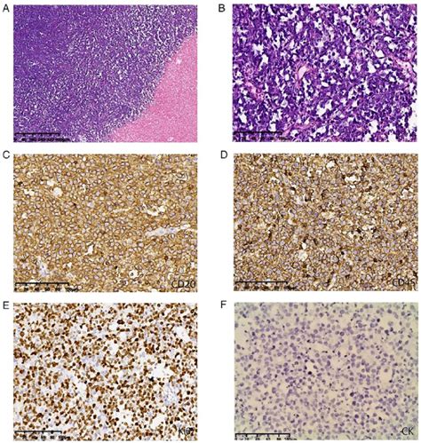 Histology and immunohistochemical images. (A) Histological analysis ...