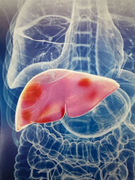 Is Your Liver Healthy? How Vitamin E Can Help! – Reveal & Heal Solutions