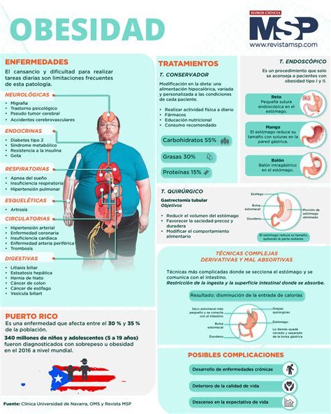 Infografia De Obesidad Clasificaci N Obesidad Tipo Ll Exceso De Masa