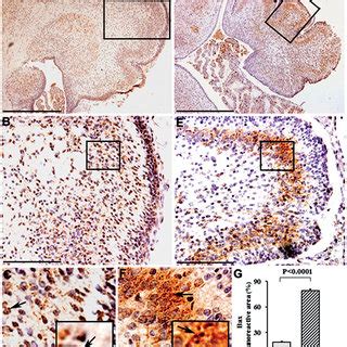 The Expression Of Bax In The Fetal Cerebella Of Control A C And The