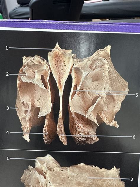 Ethmoid Anterior View Diagram Quizlet