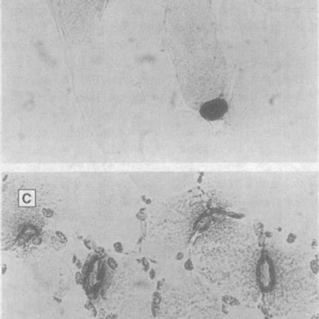 Photomicrographs Of Transverse Cryostat Sections Stained For