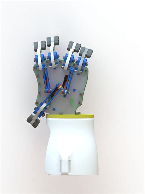 Smart Prosthetic Hand: A Revolution in Prosthetic Technology・ STL File