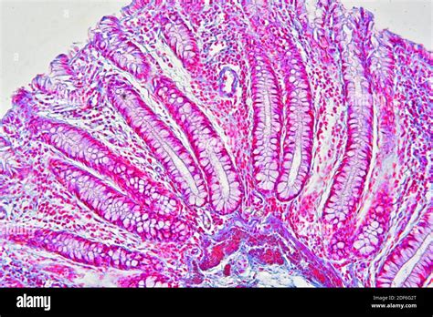 large intestine mucosa  submucosa  res stock photography