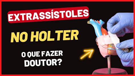 Extrassistoles O Que É