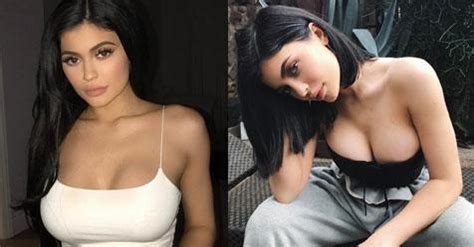 Why We Need To Talk About Kylie Jenner S Boob Job