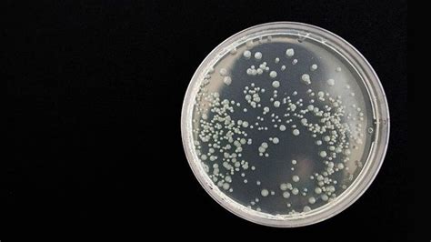 Insight Into How Bacteria Acquire Drug Resistance | Technology Networks