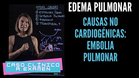 CASO CLÍNICO I 4º PARTE La embolia pulmonar como causa no