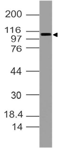 Anti Rb1 Antibody Abm17h9 10 1035