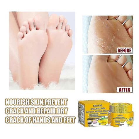 Skin Cracked Banana Repair Cream Foot Maintenance Anti-dry Cracking