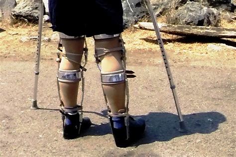 Leg Braces On The Trail Kafo Braces And Crutches Flickr