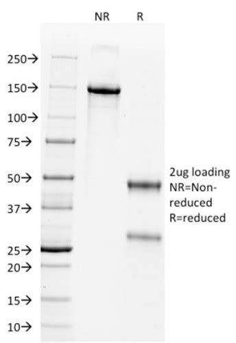 Wilm S Tumor 1 Wt1 Wilm S Tumor And Mesothelial Marker Monoclonal Antibody Wt1 857 7490