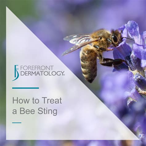 Treat Bee Sting On Foot