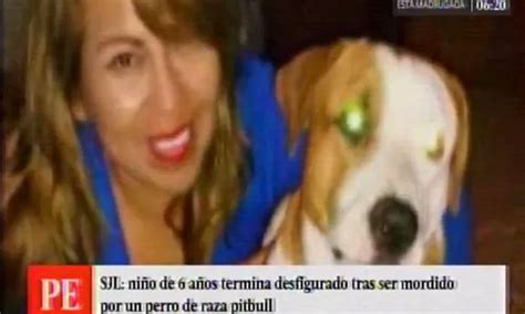 Niño quedó con el rostro desfigurado tras ataque de pitbull en SJL