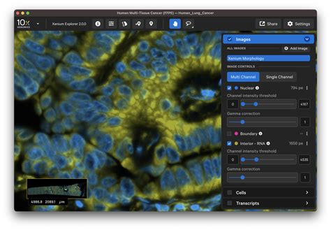 Checking Xenium Data Quality Official 10x Genomics Support