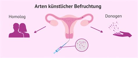 Künstliche Befruchtung Methoden Ablauf Kosten und Risiken