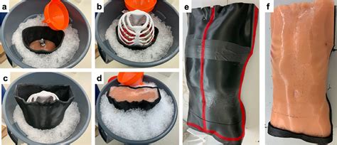 A D Printed Patient Specific Ultrasound Phantom For Fast Scan