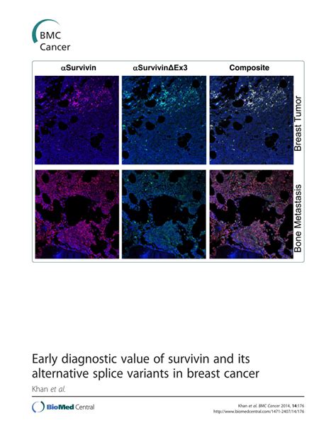 PDF Early Diagnostic Value Of Survivin And Its Alternative Splice