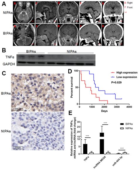 Aging LncRNA MEG8 promotes TNF α expression by sponging miR 454 3p in