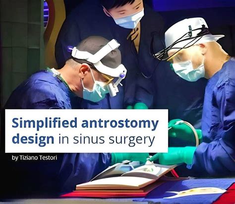 Simplified Antrostomy Design in Maxillary Sinus Surgery – Dental Knowledge