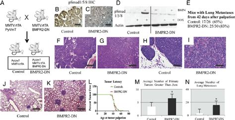 Disruption Of BMPR2 In MMTV PyVmT Mice Accelerates Tumor Progression