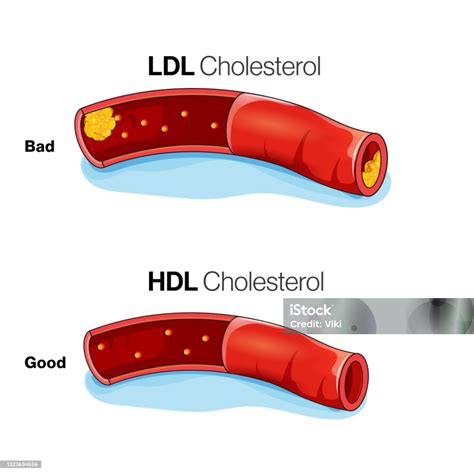 ilustrasi lipoprotein kepadatan rendah  ldl  lipoprotein