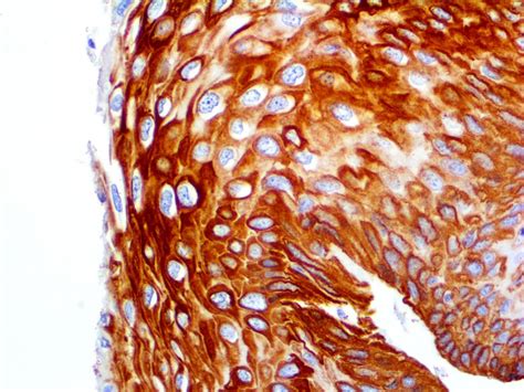 Cytokeratin 14 - MMab - Bio SB
