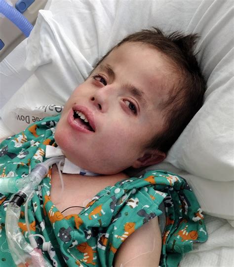 Compatible With Joy-Trisomy18: Our Week and Defining Hope