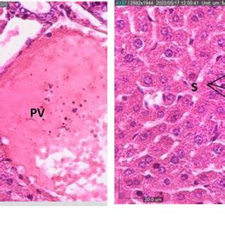 Photomicrograph Of H E Stained Sections Of Mouse Vagina From The A