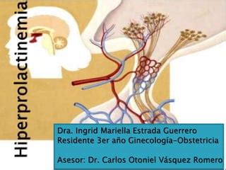 Hiperprolactinemia PPT