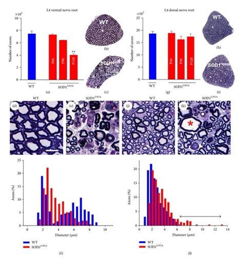 morphometric analysis  motor  vrs af  sensory  drs