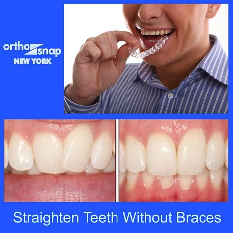 Photos On Orthosnap New York Before And After Photos 524