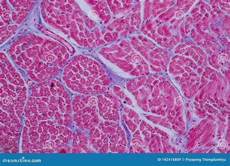 Histological Sample Heart Muscle Tissue Under The Microscope Stock