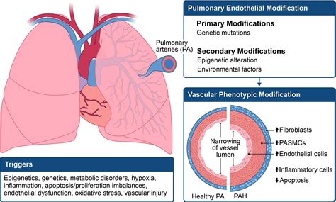 frontiers exploring  pathogenesis  pulmonary vascular disease