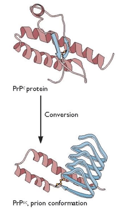 Resistance To Prion Disease In Humans Virology Blog