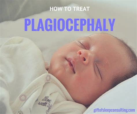 How To Treat Plagiocephaly T Of Sleep Consulting