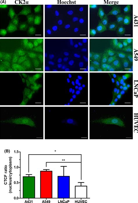 Expression pattern of CK2α in A431 A549 and LNCaP tumor cell lines