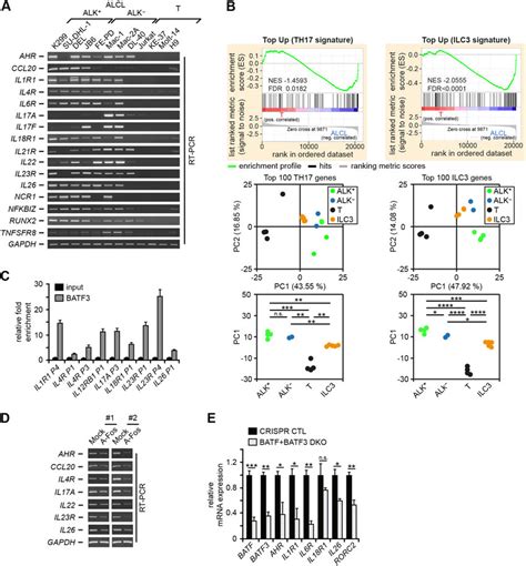 TH17 ILC3 Gene Expression In ALCL And Link To The Deregulated