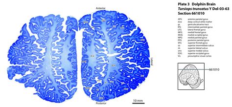 Atlas of the Brain of a Dolphin — Comparative Brain Anatomy