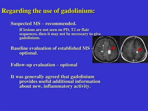 Ppt Guidelines For A Standardized Mri Protocol For Ms Powerpoint