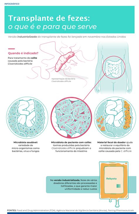 Eua Aprovam Medicamento Para Facilitar Transplante De Fezes