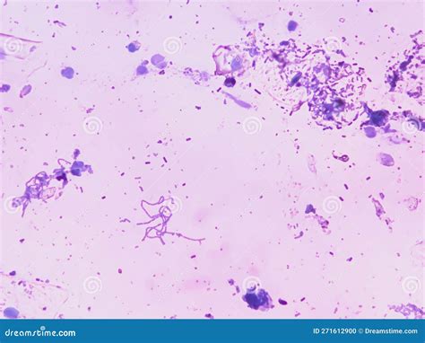 Bacillus Megatherium Microscopic Gram Staining Royalty Free Stock Image