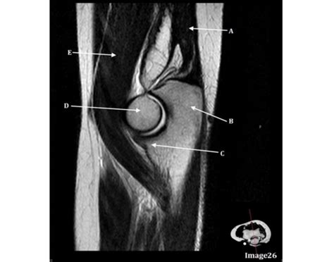 Elbow Mri Mriquiz Quiz