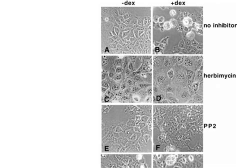 Src Kinase Inhibitors Prevent Src Induced Morphological Changes In A