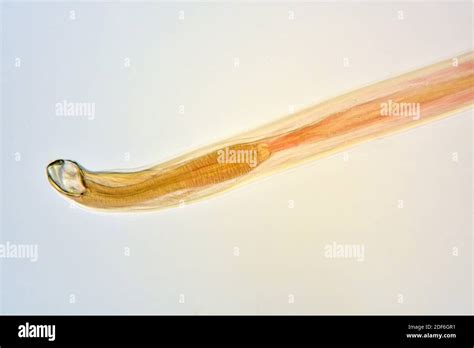Roundworm Parasite