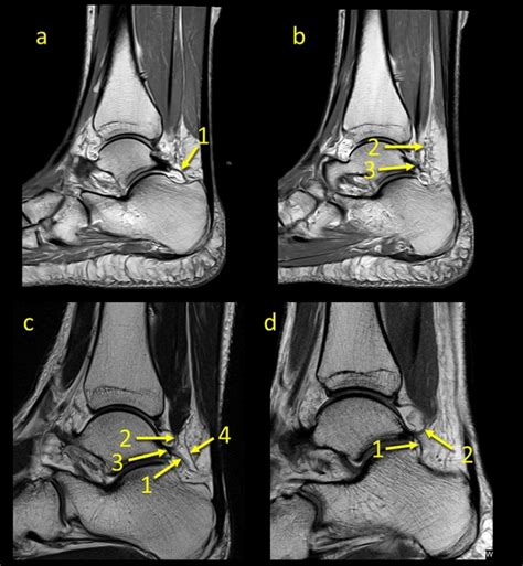 The Kagers Fat Pad Radiological Anatomy Revised Abstract Europe Pmc