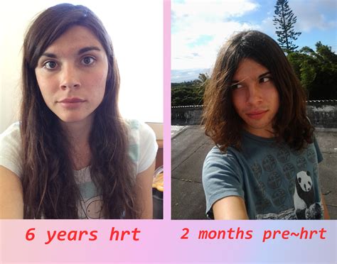 Image result for mtf transition before and after | Mtf transition