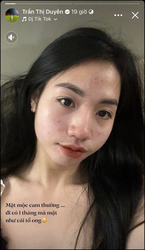 Hot Girl I Tuy N N Chi M C U V N Nhan S C Sau Th Ng I B Ng H Ng H T Da M T