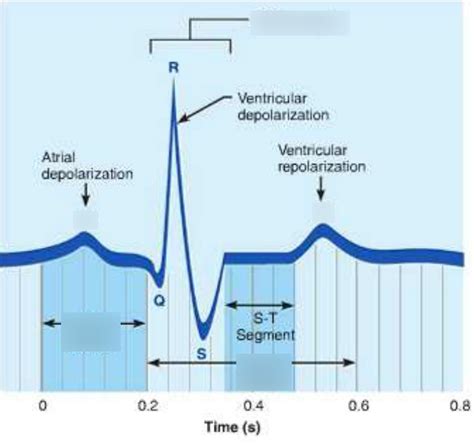 Lab Three Electrocardiogram Tracing Diagram Quizlet